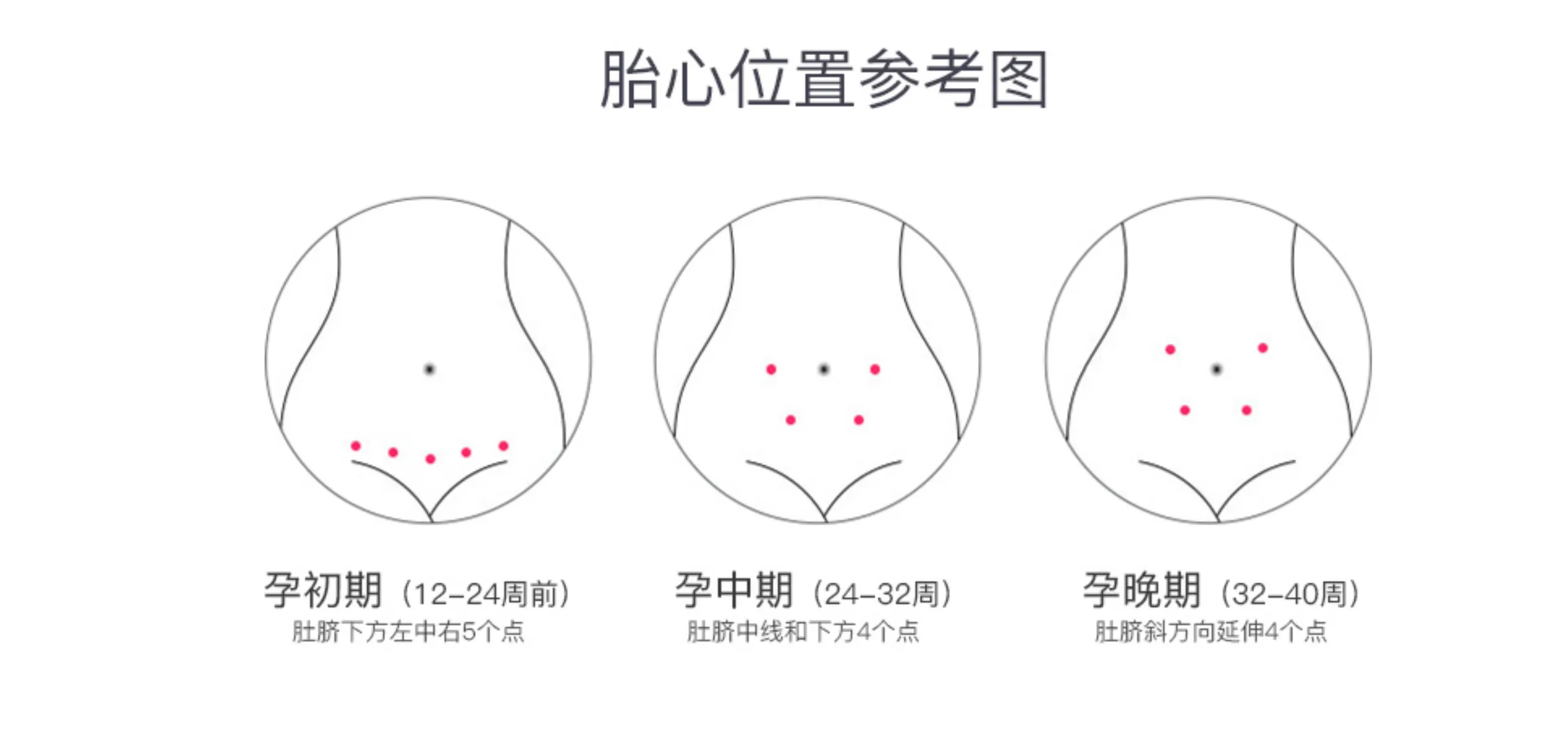 胎心位置參考圖